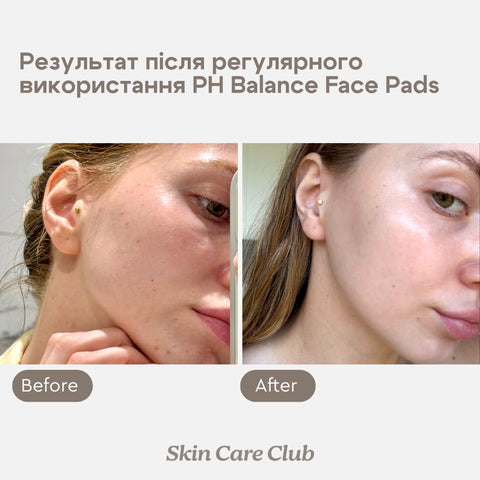 PH BALANCE PADS