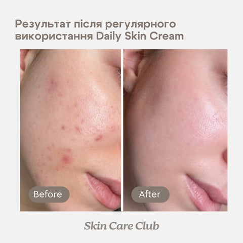 DAILY SKIN CREAM